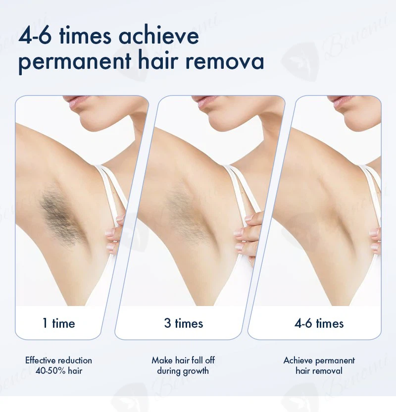 ND-YAGDiode-laser-D109 ND-YAGDiode-laser-D109