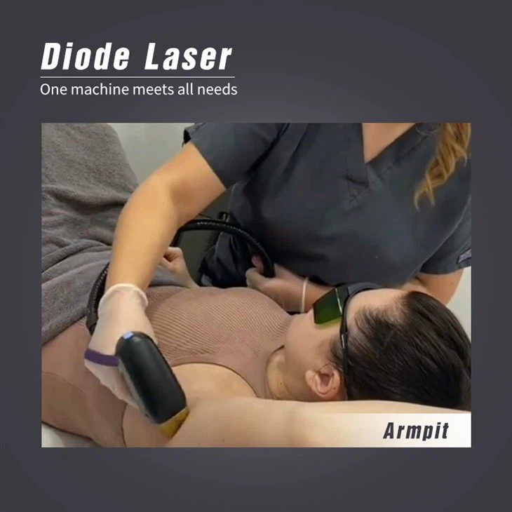 2023 Titanium Diode Laser Hair Removal Machine