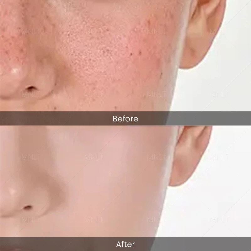 980nm 1470nm 635nm Endolaser Machine factory