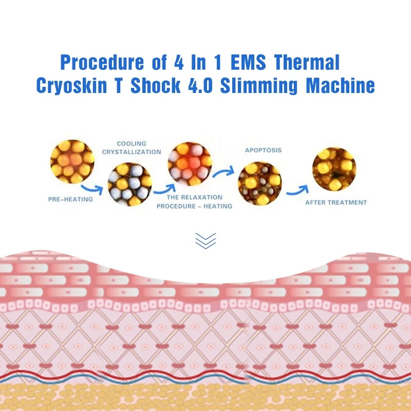 Cryo Skin Tightening Machine – Triple-Action Fat Reduction & Skin Rejuvenation