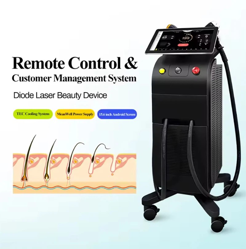 Diode-laser-hair-removal-machine-with-4-wavelengths Diode-laser-hair-removal-machine-with-4-wavelengths