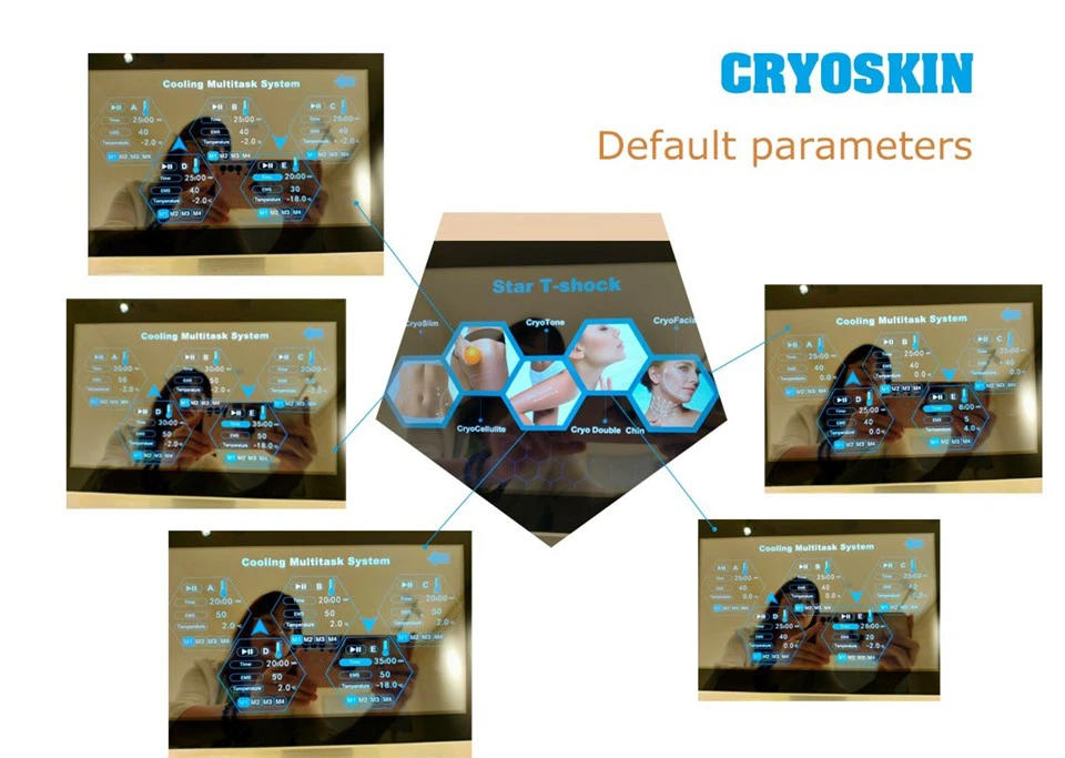 Star T-shock Machine high quality